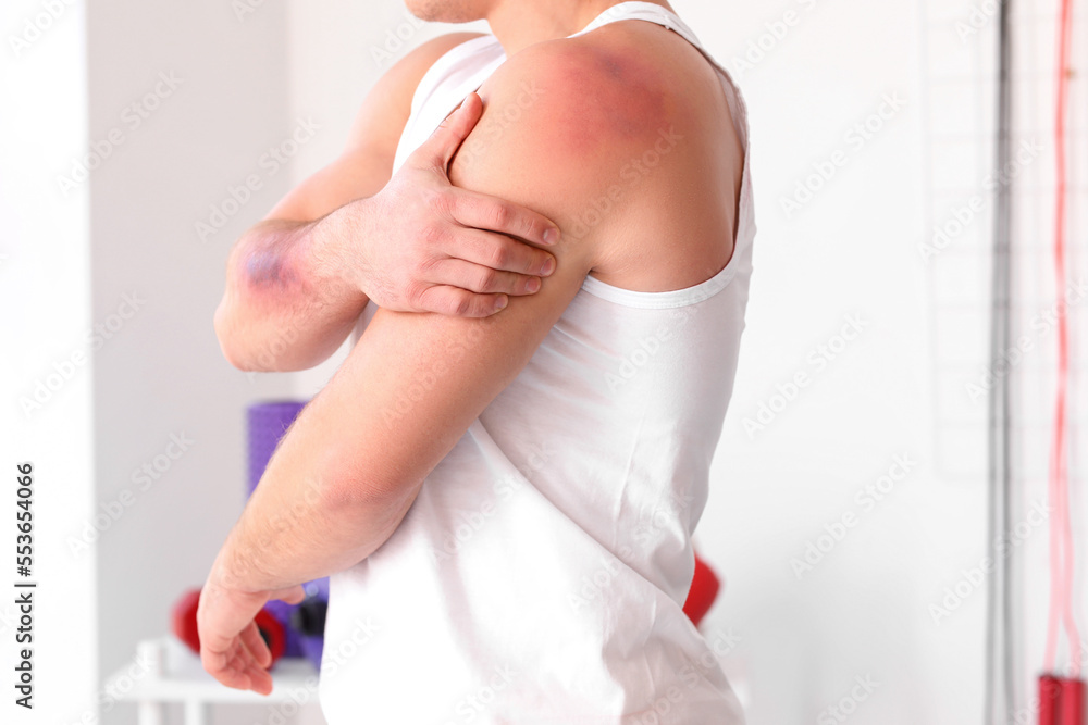 Sporty man with bruises on body in gym