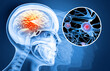 Human brain damage and treatment concept. 3d illustration