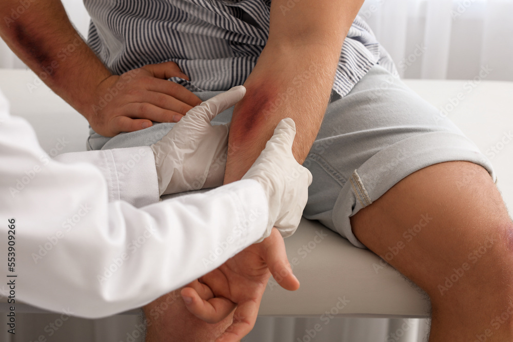 Doctor examining man with bruises in clinic, closeup