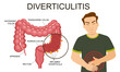 Diverticulitis and diverticulosis vector illustration. Medical structure and location. Diverticula infected or inflamed. Intestines. Bowel colon cancer, crohn's disease polyp hernia rectum	
