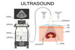 Ultrasound analysis equipment and process vector illustration. Radiology scanner for medical research and diagnosis. Sonar computer with wave reflection transducer medical poster. Kidney ultrasound.