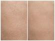 Collage demonstrating comparison of dry and moisturized human skin, closeup