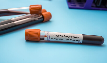 Sticker - Cephalosporins  Allergy RAST IgE Blood Tests. Test tube on blue background