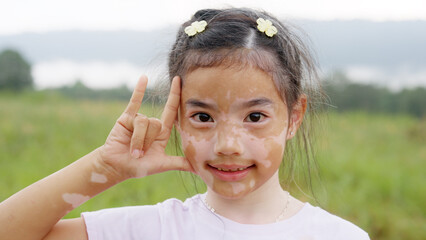 Wall Mural - Little cute alpha young albino vitiligo small girl relax smile give heart hand sign look at camera. Melanin face body care hair color of asia people gen z kid self love happy proud of diverse skin.