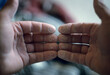 © Cavan Images - finger tips raw from rock climbing