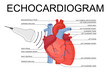Echocardiogram. Heart ultrasound. Medical Vector Human Heart illustration of Echocardiogram and heart anatomy. Cardiology Echo test. Diagnose cardiac problem. Preventing diagnosing heart attack. 