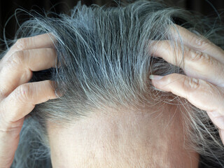 White hair and gray hair of Thai elderly women, Hair health problems with hair loss and thinning.