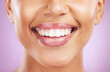 © C Davids/peopleimages.com - Happy woman, face or dental care on purple studio background or teeth whitening, invisible braces treatment or grooming. Zoom on beauty model smile or cosmetic mouth hygiene and healthcare cleaning