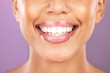 © C Davids/peopleimages.com - Happy woman, face or dental care on purple studio background or teeth whitening, invisible braces treatment or grooming. Zoom on beauty model smile or cosmetic mouth hygiene and healthcare cleaning
