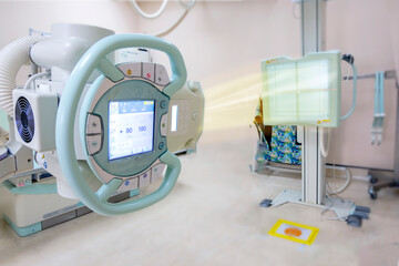 X-ray generator tube with monitor  or X-ray general device with Bucky stand in radiology .modern medical equipment in the hospital.