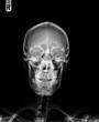 © Nut - Film x- ray skull AP normal