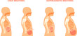 Diaphragmatic breathing. Pulmonary exercises chest and abdominal breath training, relax trachea respiration technique, inhale exhale medical infographic poster vector illustration