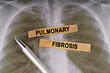 On a human chest x-ray, a pen and strips of paper labeled - pulmonary fibrosis