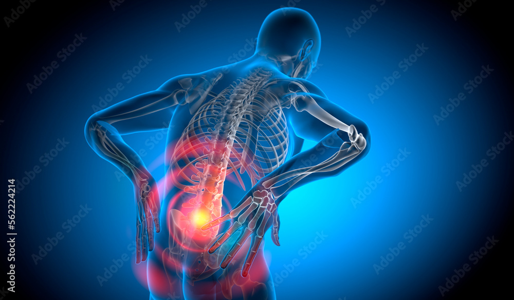 X Ray 3D Rendering - Man with severe pain in the lower spine and ...