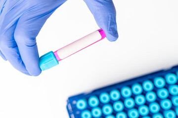 Wall Mural - medical test tube with a blood sample in the doctor's hand against the background of a cassette with other test tubes