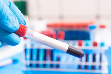 Poster - medical test tube with a blood sample in the doctor's hand against the background of a cassette with other test tubes