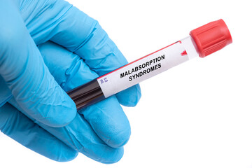 Poster - Test tube with a blood sample for laboratory analysis with a bla