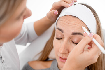 beautician makes marks on female face for botox injection procedure.