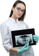 © Mountains Hunter - Girl dentist in a white coat holds a snapshot of the patient's teeth.