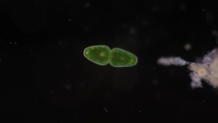 Wall Mural - Algae and Protist in waste water under the microscope.