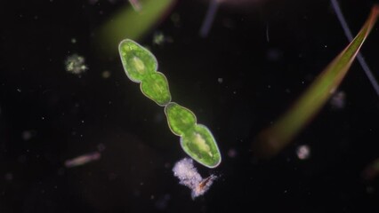 Wall Mural - Algae and Protist in waste water under the microscope.