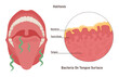 Oral hygiene concept. Halitosis, chronic bad stinky breath, bacterial