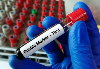 Poster - Blood sample for Double Marker Test. Pregnancy marker.