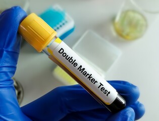 Sticker - Blood sample for Double Marker Test. Pregnancy marker.