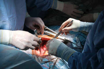 Wall Mural - Closeup of professional doctor hands operating a patient during open heart surgery in surgical room. Healthcare and medical intervention concept