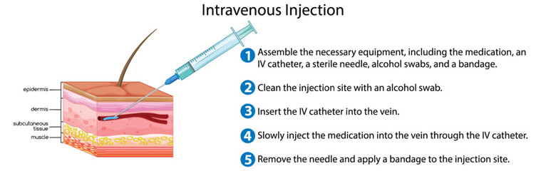 Wall Mural - Intravenous Injection with explanation