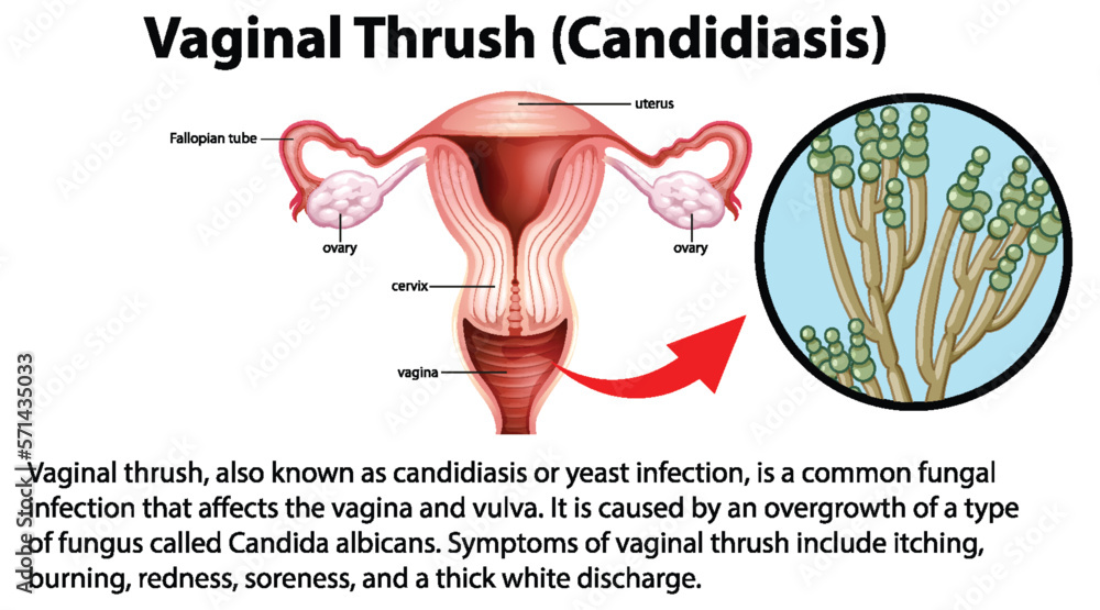 Dumbadagi tilning surati