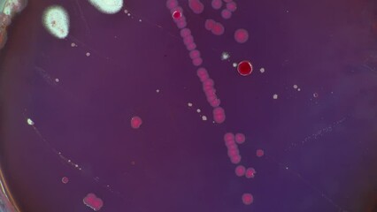 Poster - samples of fungi and bacteria grown in a petri dish from human excreta