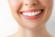 © Aleksandr Rybalko - Perfect white teeth smile of a young woman. The result of the teeth whitening procedure. The image symbolizes oral care dentistry, Closeup on a white background.