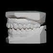 wycisk ortodontyczny