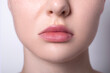© iso100production - real woman lips after lip augmentation with hyaluronic acid filler injection finished result, contour lip plastic surgery, puffy, plump lips