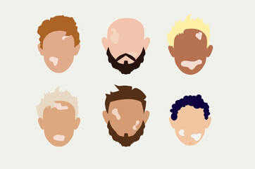 Wall Mural - Male faces with vitiligo skin disease. Portraits with different ethnics, skin colors, hairstyles. Flat vector illustration