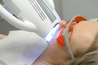 © Oleksandra - close-up of a woman's face under apparatus Beyond Poluse Plus Advanced Whitening System with Dental UV Laser Whitening Device in glasses protective against ultraviolet whitening teeth