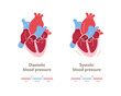© tasty_cat - Blood pressure infographic. Vector flat illustration. Health care hypertension chart. Heart organ anatomy with blood flow. Zone of low, normal, high level pressure. Design for healthcare, cardiology
