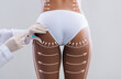 © Prostock-studio - Young slim black woman in white bikini with abstract lines gets injection from beautician in hips