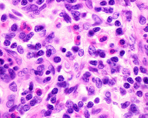 Sticker - Human appendix. Eosinophils