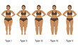 Women's body in different types of Lipedema