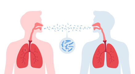 Tuberculosis disease concept. Vector flat healthcare illustration. People silhouette with lung infect other by tb isolated on white background. Design element for health care, education, pulmonology