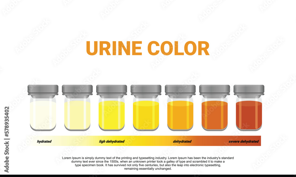 Illustration of urine color chart