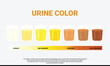 Illustration of urine color chart