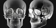 A radiograph or X-ray image of a human skull, showing both front and lateral views - Generative AI