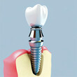 dental implant model showcases the intricacies of modern dentistry, with a titanium screw mimicking a tooth root and a crown replicating the natural tooth, generative ai.