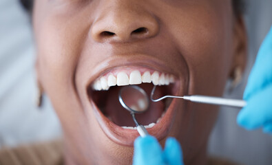 Wall Mural - Checkup, teeth and woman with a dentist for oral hygiene, cavity check or cleaning mouth. Zoom, dental and doctor with mirror to look at the tooth of a girl for healthcare, treatment and examination