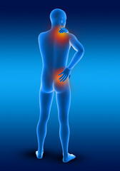 Poster - 3D male medical figure holding his neck and back in pain