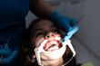 © Minet - Close up of girl with brackets receiving dental braces treatment in clinic