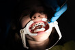 © Minet - Close up of girl with brackets receiving dental braces treatment in clinic